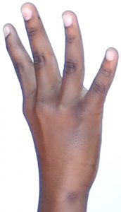 four fingers