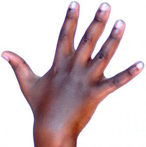 five fingers